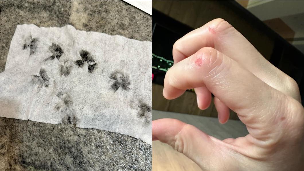 宋哥曬出清理鼻孔照片,仍有滿滿的落塵,手也清理到破皮。(圖/翻攝自宋依璇臉書)