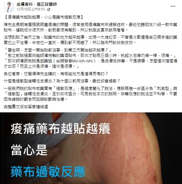 痠痛貼布越貼越癢,可能是過敏反應。(圖/翻攝自葛正詳臉書)