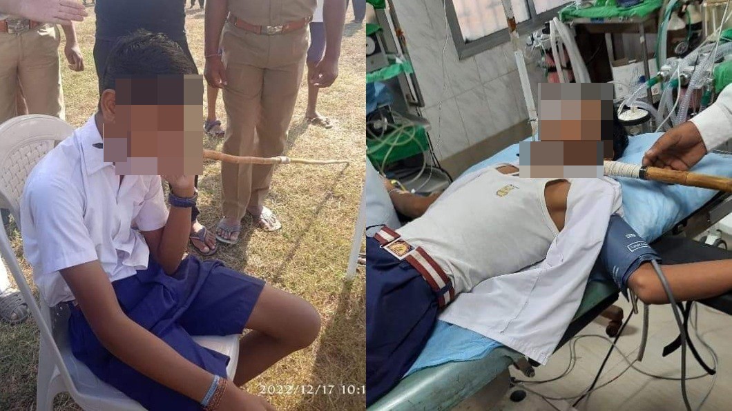 嚇!少年被標槍「射穿脖子」 淡定走上救護車就醫