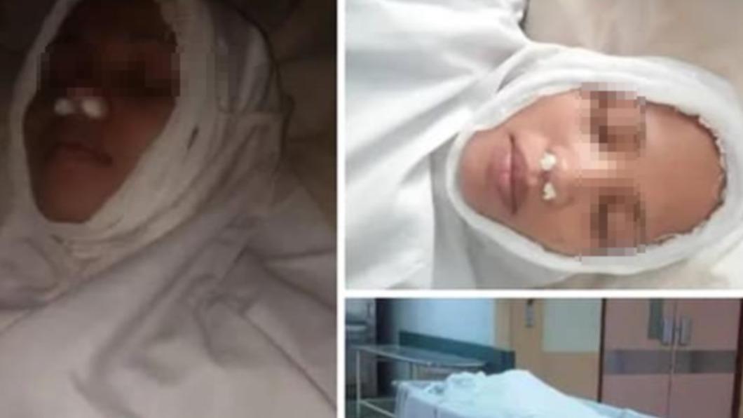 不想還錢！她「狂傳屍體照」鼻子塞衛生紙裝死　真相曝光慘了