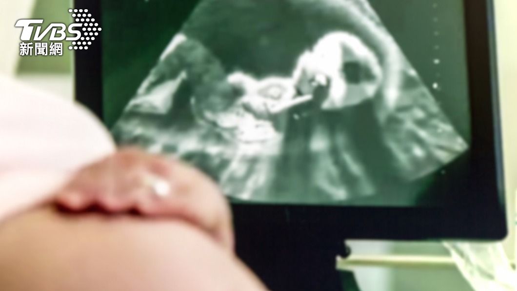 女友刺破保險套!他收「超音波照」崩潰:最可怕耶誕禮物