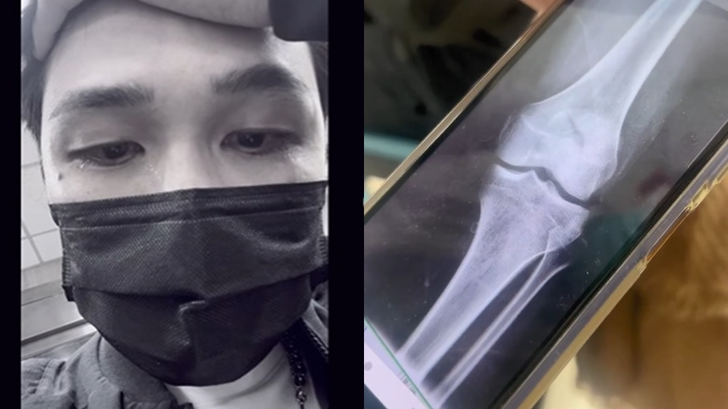 演員葉益豪膝蓋骨折斷裂，被告知半年不能跳舞淚崩。（圖／翻攝葉益豪IG）
