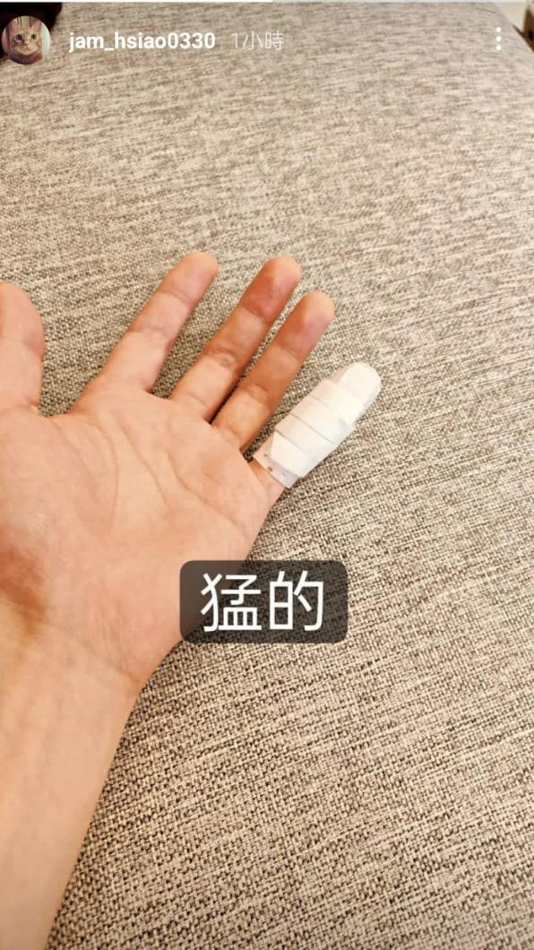 蕭敬騰PO出小姆指傷勢。(圖/翻攝自蕭敬騰IG)