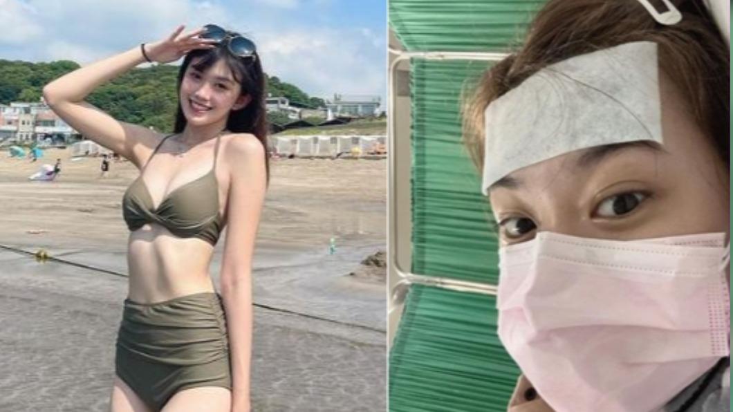 21歲台劇女神「吐血送醫」心臟爆痛!指甲離奇變紫 急治療續命