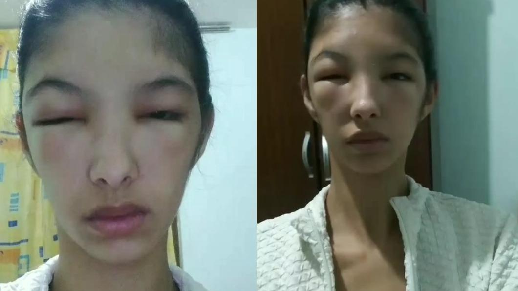 路易莎以自身經驗提醒粉絲,自己染髮一定要注意過敏問題。(圖/翻攝自IG)