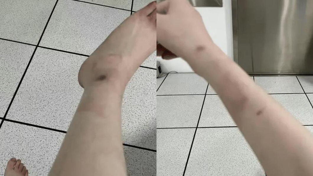 她控訴自己遭囚禁2個月被綁住手腳還強制灌藥。（圖／翻攝自網易新聞）