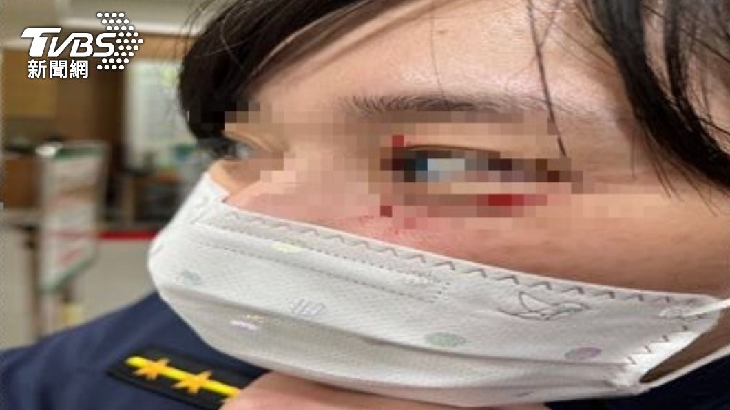 女警眼皮受傷。（圖／TVBS）