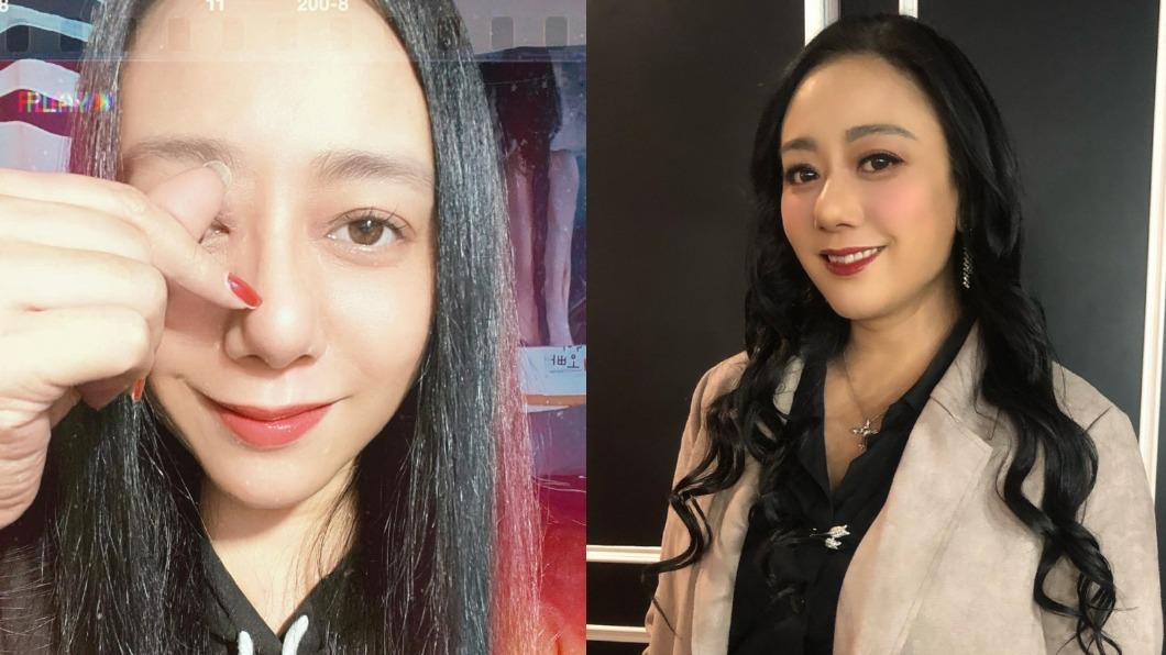 高慧君「嚴重斜視」患眼疾1年半近況曝! 顧病母燒光積蓄借貸百萬