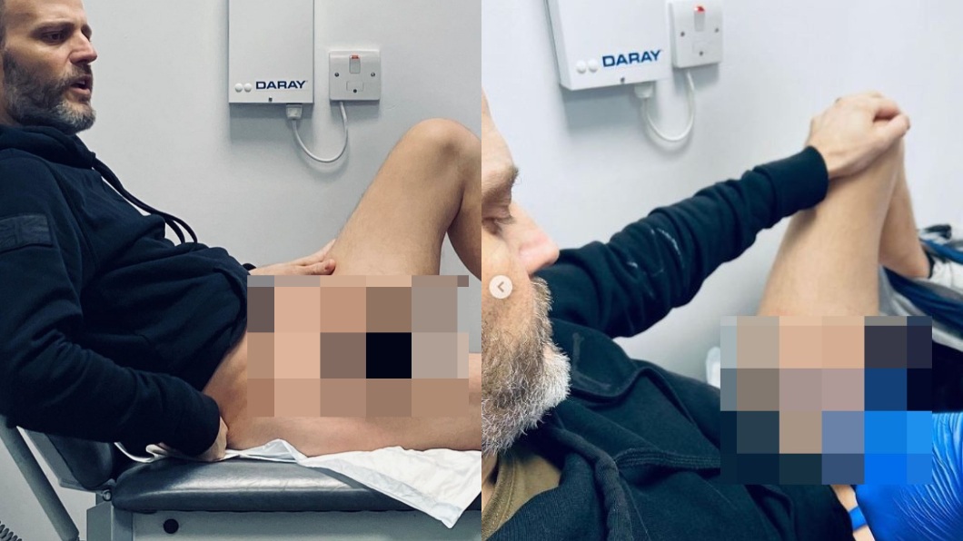 男子稱說一開始被診斷是菜花和鵝口瘡,導致被誤診害他被迫切掉一半陰莖。(圖/翻攝自當事人IG@screamingcockerel)