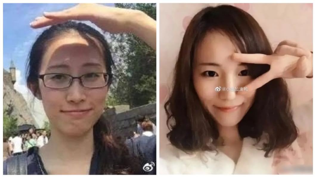 前男友尋仇!女推閨密擋刀犧牲 賠3百萬竟網路募款幫還