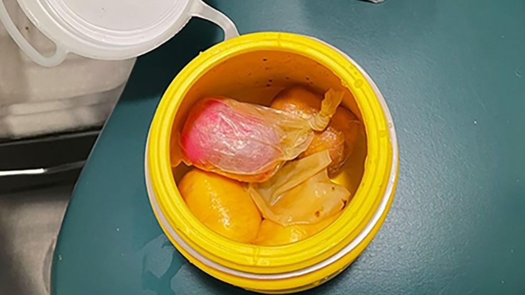 古柯鹼塞入6顆健達出奇蛋藏體內 男澳機場闖關被逮