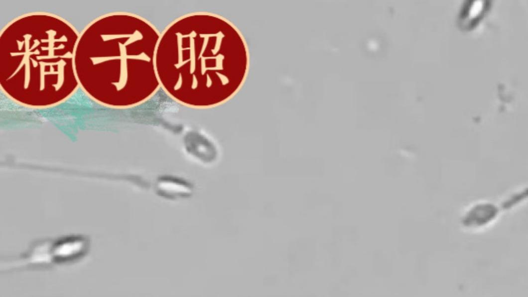 醫曬確診後精子老化照 苦勸「陽康」先別生!