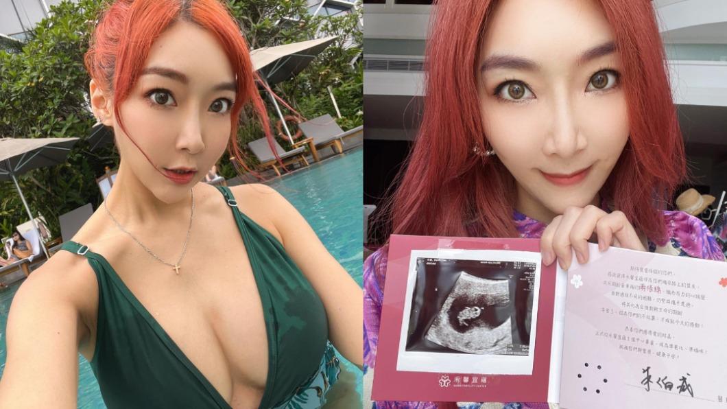 恭喜!北一女學霸又有了 將當五寶媽曬超音波照報喜