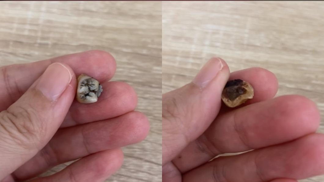 好市多蛤蜊濃湯驚見「黑色臼齒」！　牙醫出面揭「是他的」