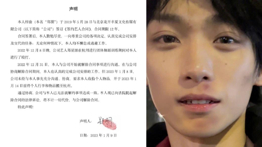 梓渝屢遭粉絲發現臉上有瘀青（右圖），昨他發聲明揭露遭毆打並和公司解約的內幕。（圖／翻攝自極速小魚、圈內妹妹微博）
