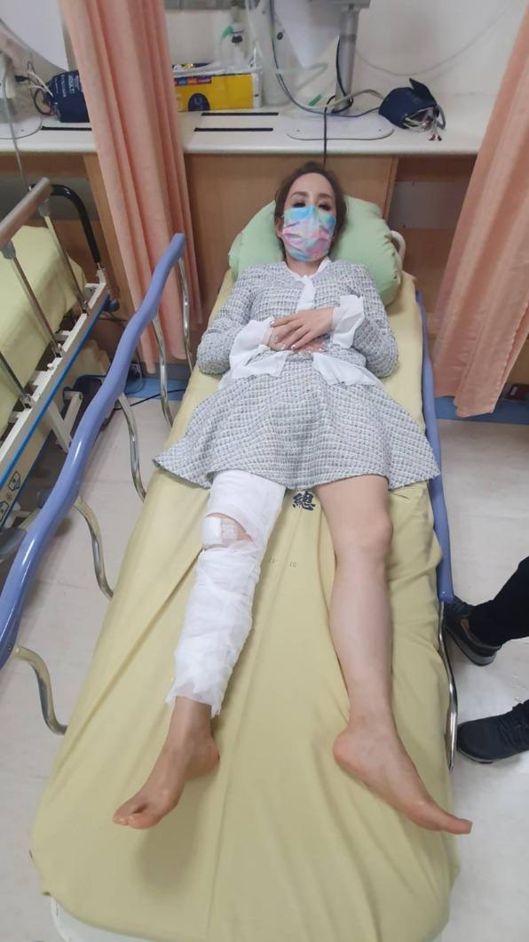 許聖梅曾摔倒骨折,軟骨碎成2半。(圖/翻攝自許聖梅臉書)