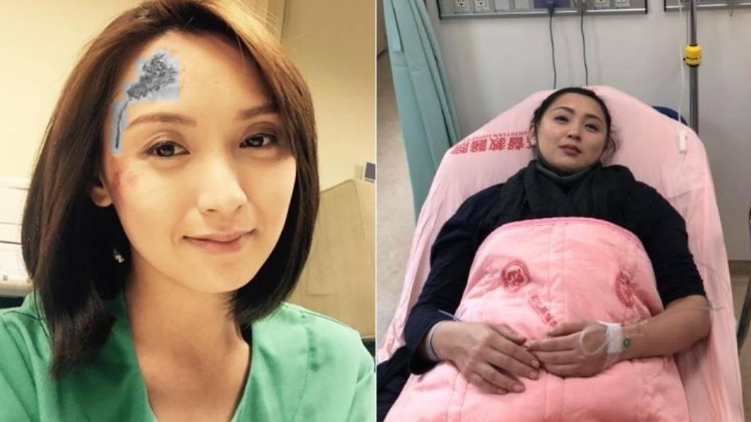 本土劇女星母「開腦血割」！9公分惡性腫瘤　哭吼：母女都癌