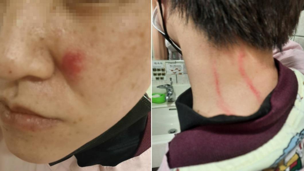 快訊／醫療暴力！非探視時間到訪　男遭拒竟揮拳毆打護理師