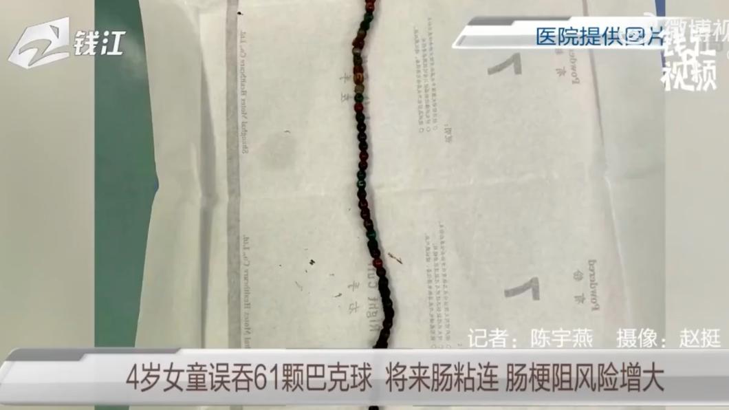 從女童腸道中取出的61顆巴克球,造成了14處腸穿孔。(圖/翻攝自微博)