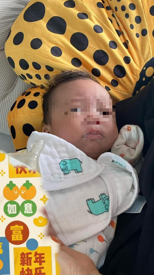 張齡予的兒子小班長的嘴巴被黴菌感染。(圖/翻攝自張齡予臉書)