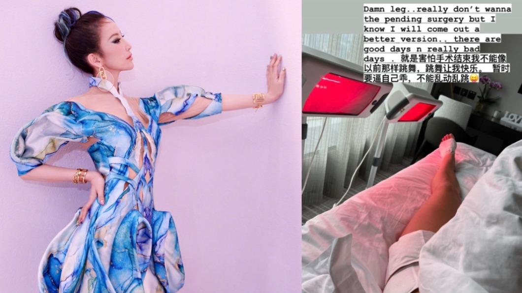 李玟感嘆自己左腳舊傷難治,卻又害怕手術後不能再跳舞了。(圖/翻攝自李玟微博、IG)