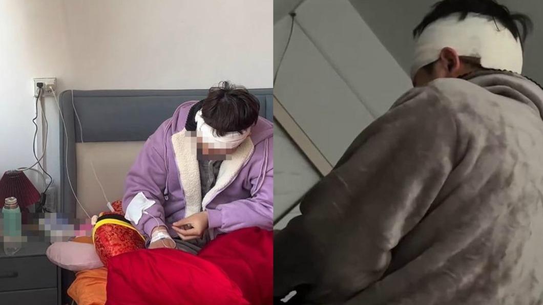 痛毆新婚尪!狠妻自豪超常發揮 濺血照驚呆網:男女憑拳?