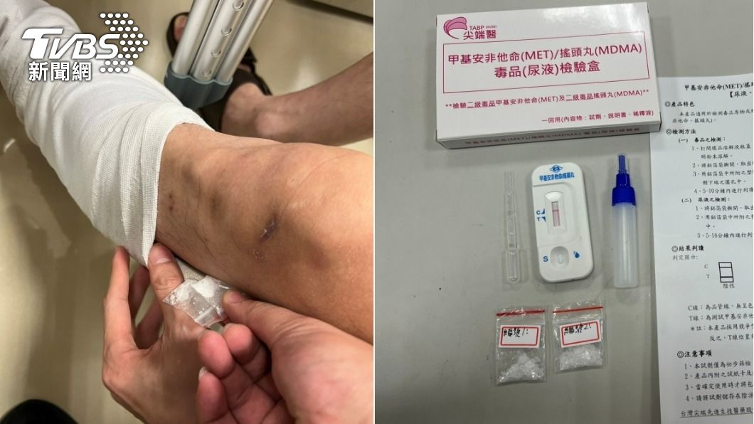 以為躲得過!毒蟲遭盤查裝「掰咖」 原來石膏內藏了這東西
