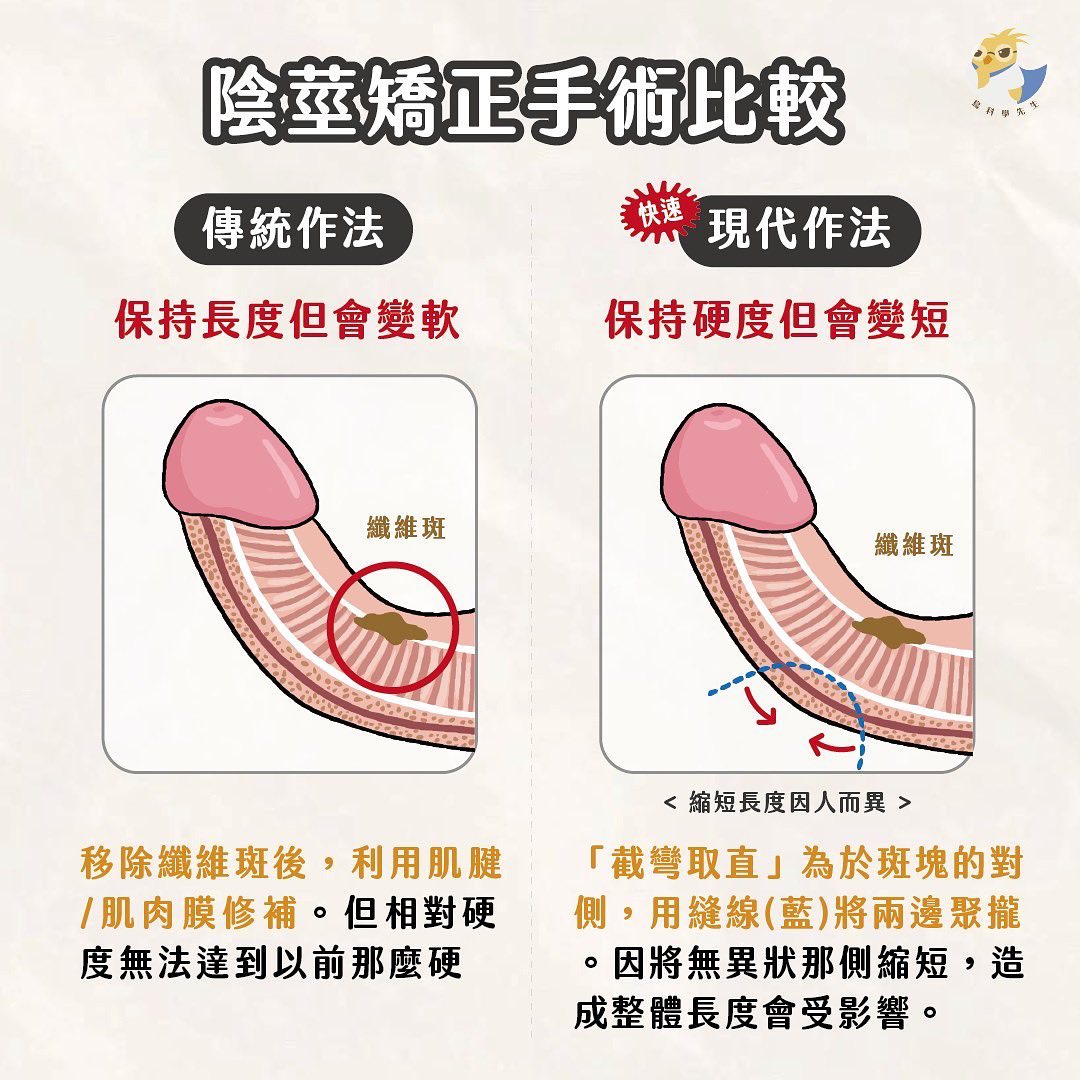 矯正手術比較。(圖/顧芳瑜醫師提供)