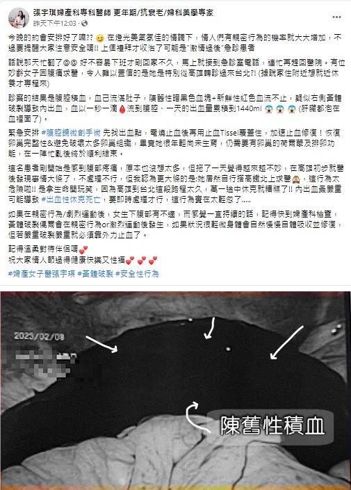 醫師張宇琪分享個案。(圖/翻攝自張宇琪婦產科專科醫師臉書)