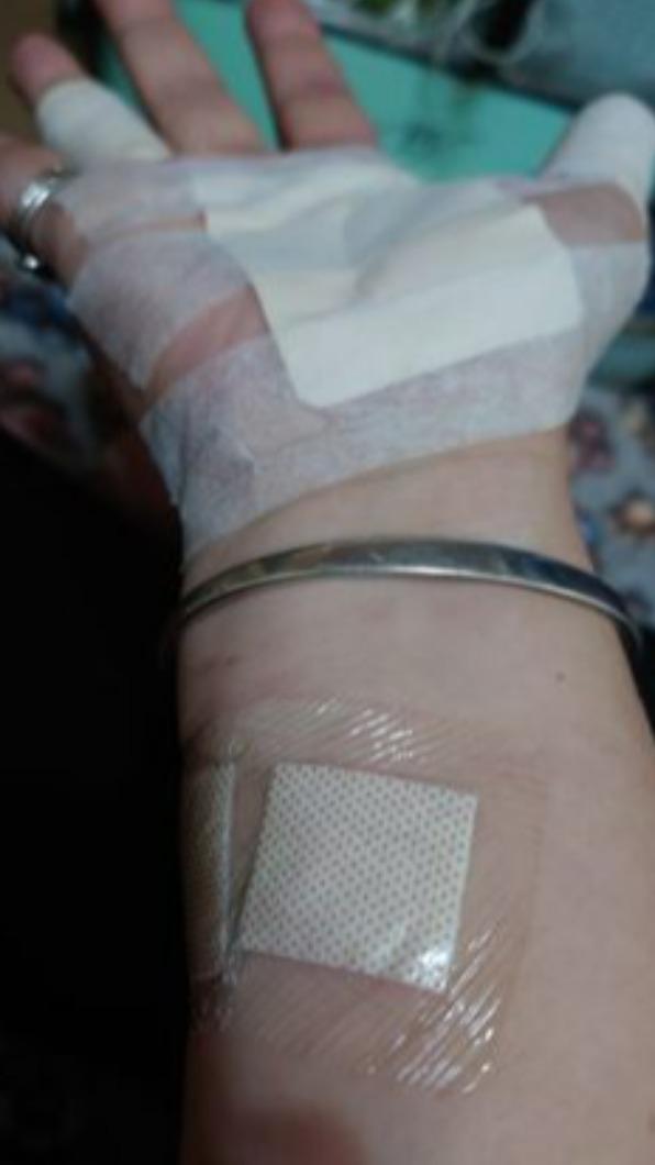 林女氣到手鐲都拍斷,導致手腕受傷。(圖/翻攝自當事人臉書)