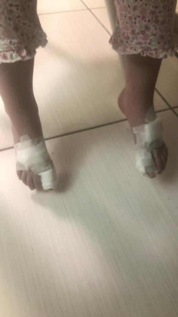 有孩童的腳被刺傷。(圖/劉仁照提供)