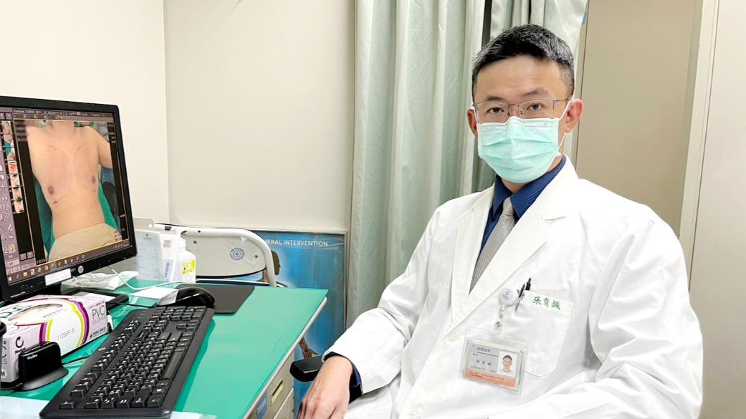 澄清醫院中港院區整形外科醫師張育誠。(圖/院方提供)