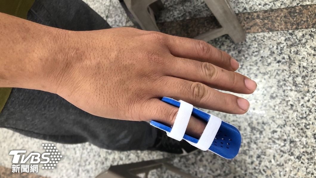 潘姓員警左手第五指閉鎖性骨折。(圖/警方提供)