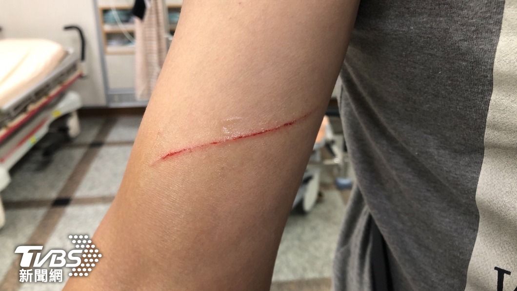 員警受傷情形。(圖/警方提供)