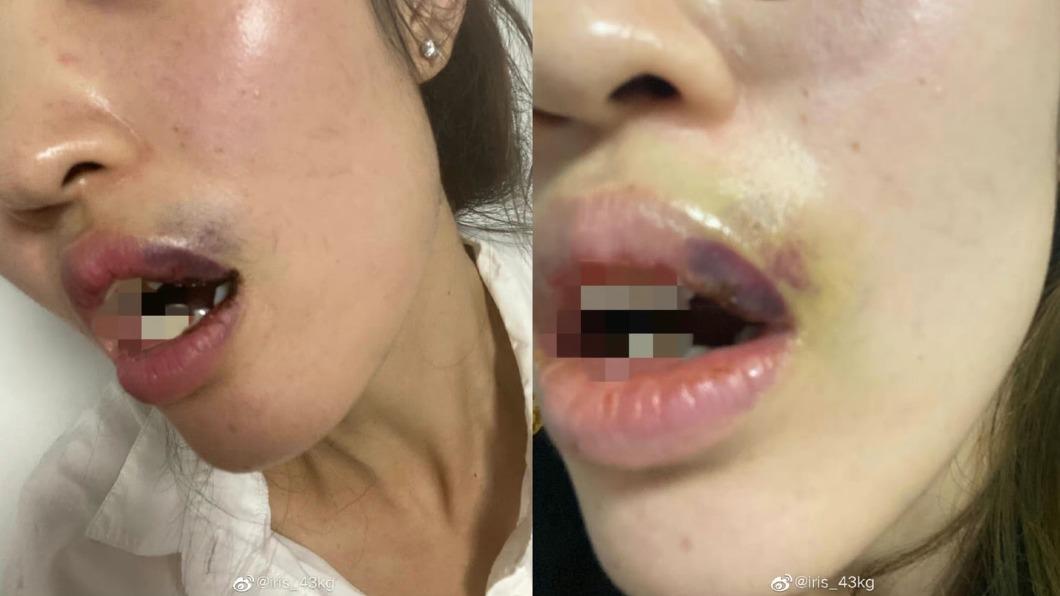 女網友曬被吳翰施暴的證據。(圖/翻攝自iris_43kg微博)