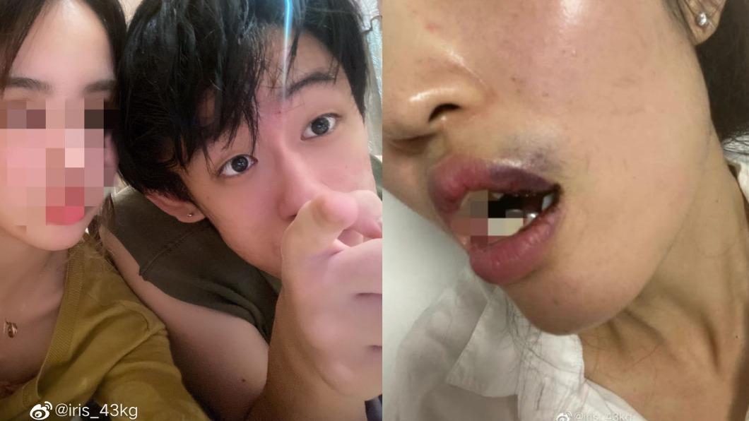 血淋淋控訴!星二代被爆痛毆前女友「嘴裡滿是血」 動粗畫面曝
