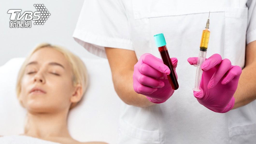 血小板濃度的高低，是影響PRP治療的關鍵。（示意圖／shutterstock達志影像）