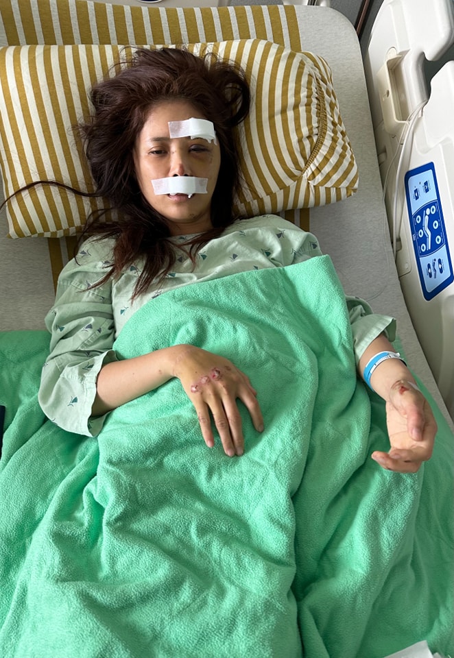 宋燕旻歷經顏面重建，如今已成功返回主播台。（圖／翻攝自宋燕旻臉書）