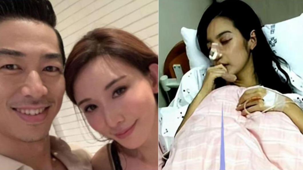 陸媒瞎爆「林志玲遭家暴」鼻子打爛!真相超傻眼 受傷女主竟是「她」