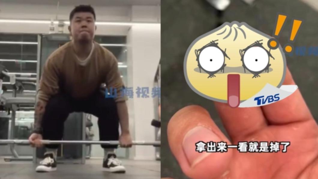 真「咬牙切齒」!陸男首試100kg深蹲 嘴吐硬物竟是臼齒