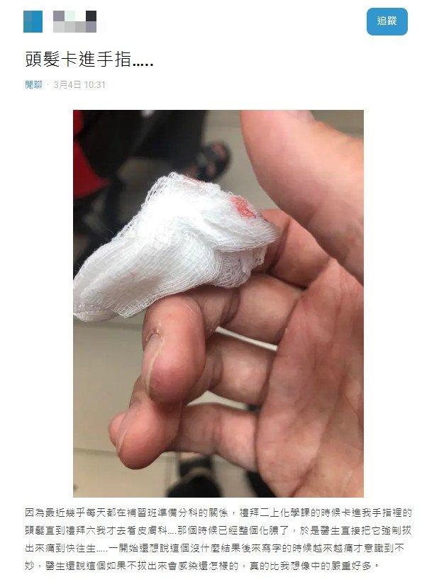醫師警告若不拔出頭髮，可能會感染。（圖／翻攝自Dcard）