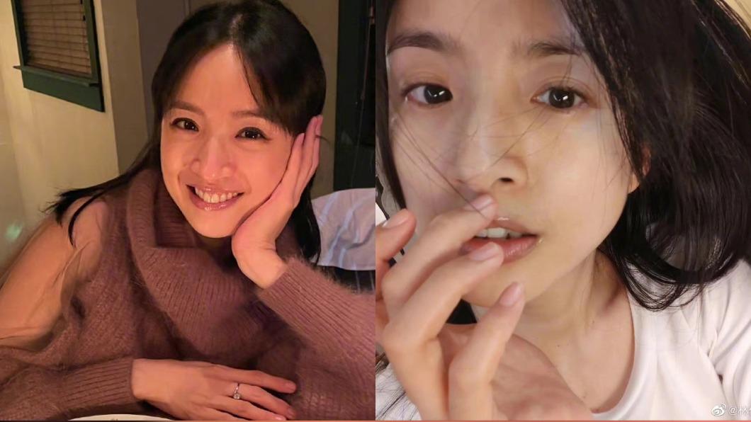 26歲為還債操過頭!林依晨「送醫驚罹腦瘤」術後療養狀況曝光