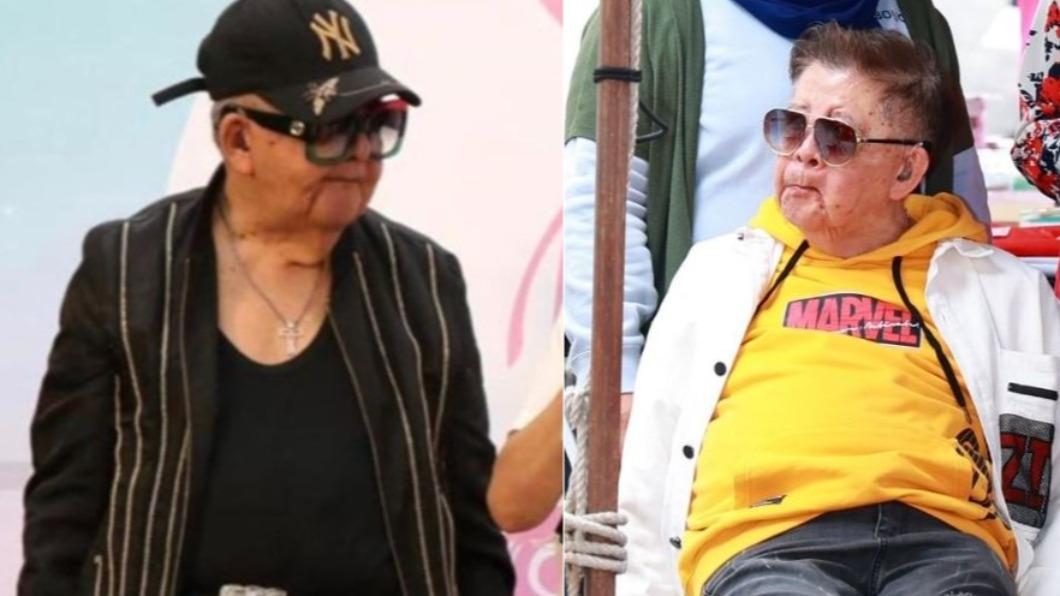 82歲秀場天王「肺積水氣切」!無工作0收入 賠光4棟房近況曝