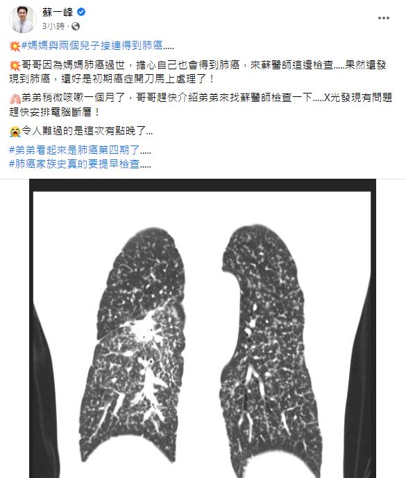 蘇一峰提醒,如果有肺癌家族史,一定要提早檢查。(圖/翻攝自蘇一峰臉書)