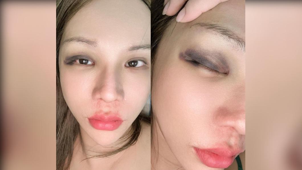 小A辣至泰國返台,溫差太大導致感冒中暑。(圖/翻攝自小A辣 IG)