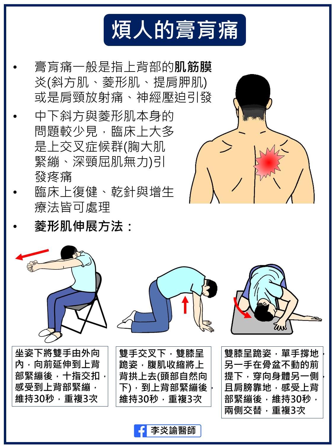 李炎諭醫師分享,3動作伸展上背肌肉。(圖/翻攝自臉書 李炎諭醫師的復健聊天室)