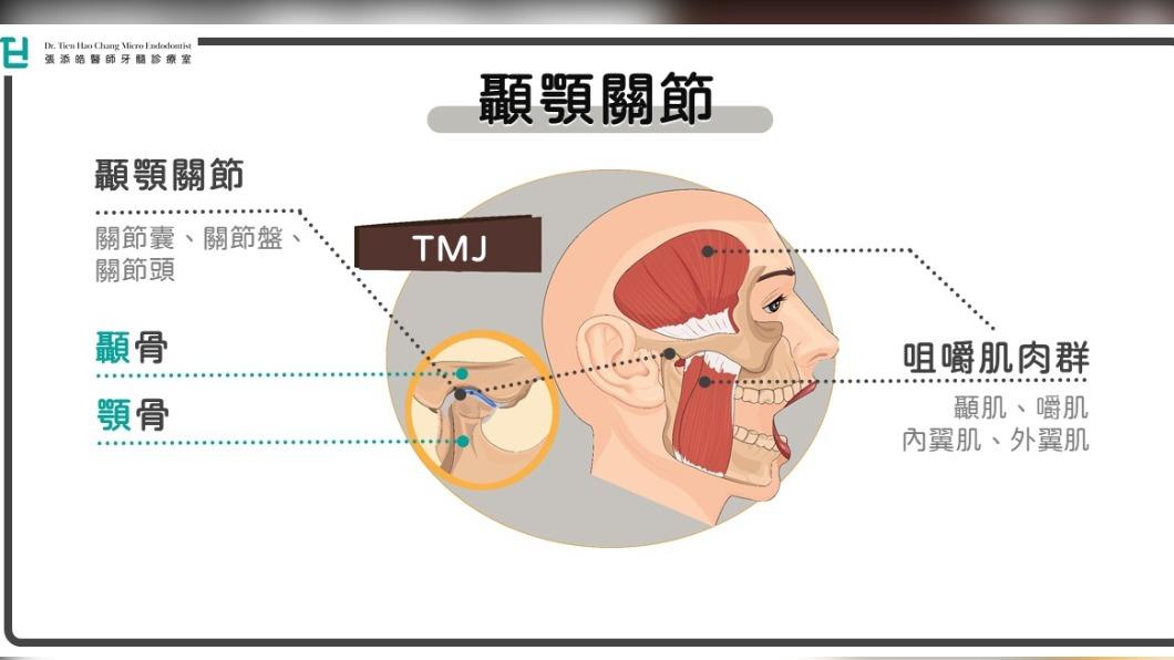顳顎關節障礙。(圖/張添皓醫師的牙髓診療室)