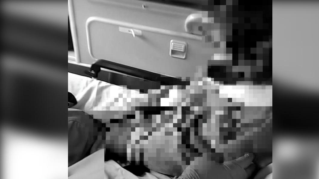 不滿女童樓梯間玩！保母出手「全身瘀傷」　走路都有困難