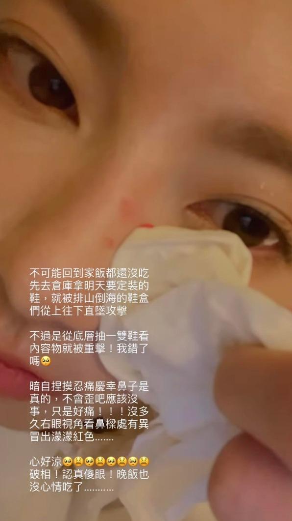 豆花妹慘遭鞋盒砸傷鼻樑，傷心表示破相了。（圖／翻攝自蔡黃汝臉書）
