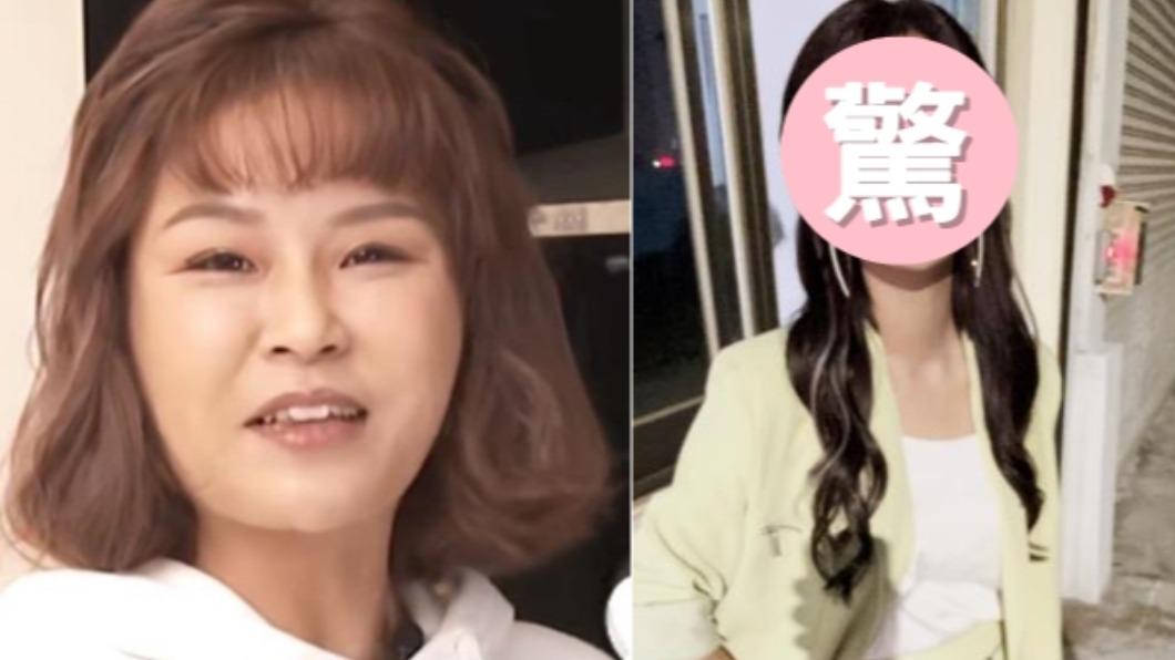 丟丟妹離婚爆「整形整壞」!暴瘦整臉變了 驚人近照曝光